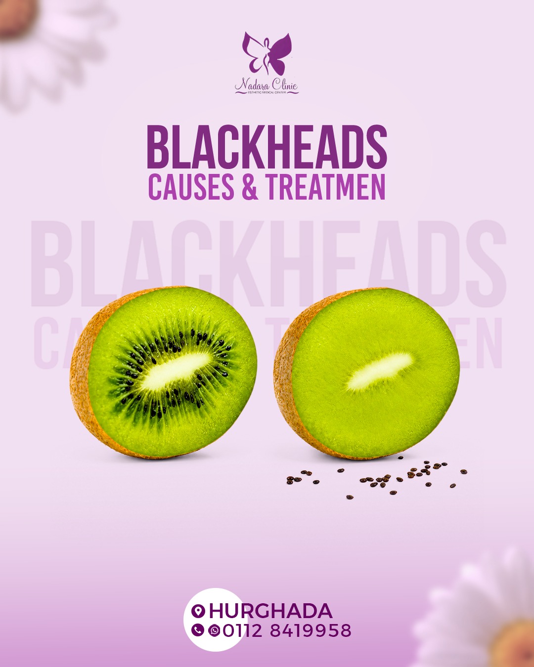 Getting rid of blackheads in Hurghada